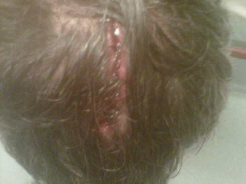 gash on Cane's top part of head
