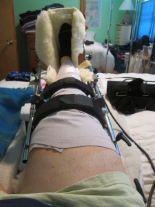 my leg on the CPM machine