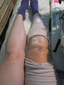 Post-surgery knee