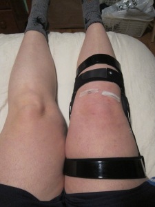 Top view of my ACL knee brace
